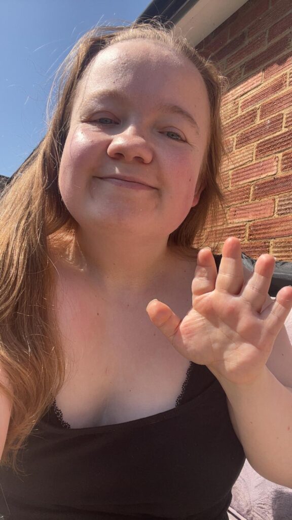 Jordan was 17 before she finally had a name for the condition that had ruled her life since childhood. Acrodysostosis Type 1 is an ultra-rare genetic disorder that affects bone development and hormone regulation and is so unfamiliar to most GPs that spotting the signs is often impossible.