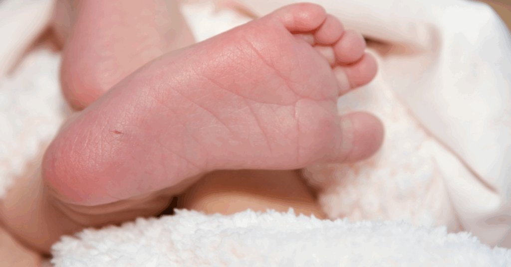 A picture of a babies foot. The heel prick test is routinely used worldwide in newborn screening to detect Phenylketonuria