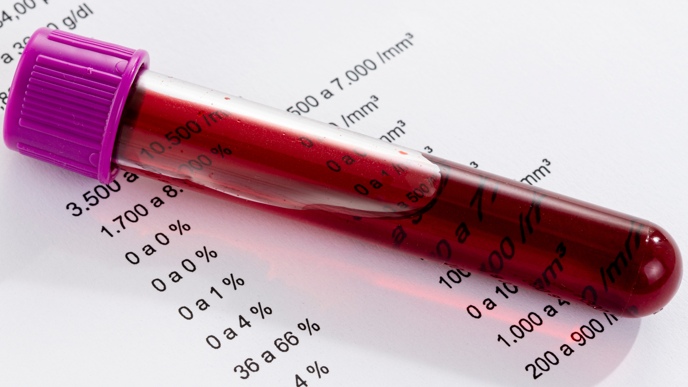 Image of a tube of blood on a sheet of paper displaying blood count