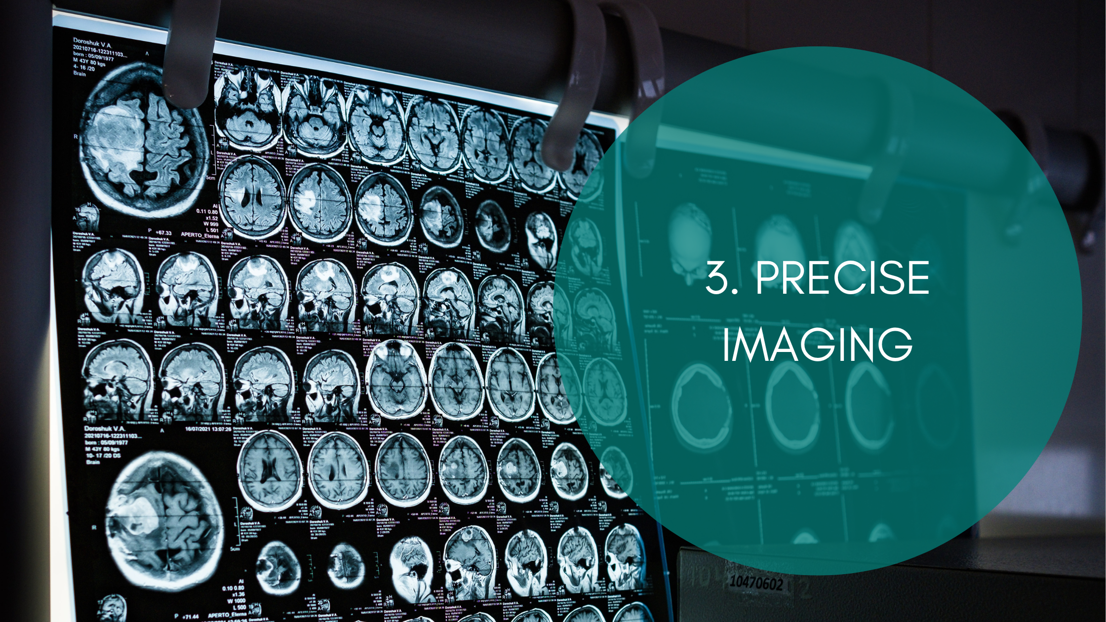 Image of brain scans