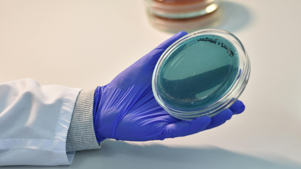Photo of a petri dish