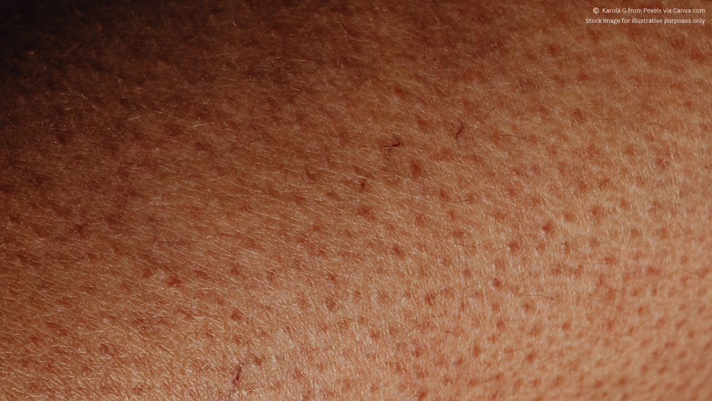 Photo of a close up of skin